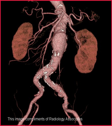 multislice ct scan price